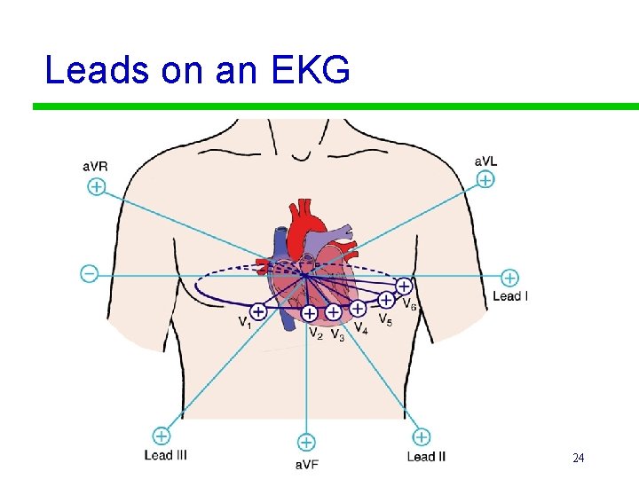 Leads on an EKG 24 