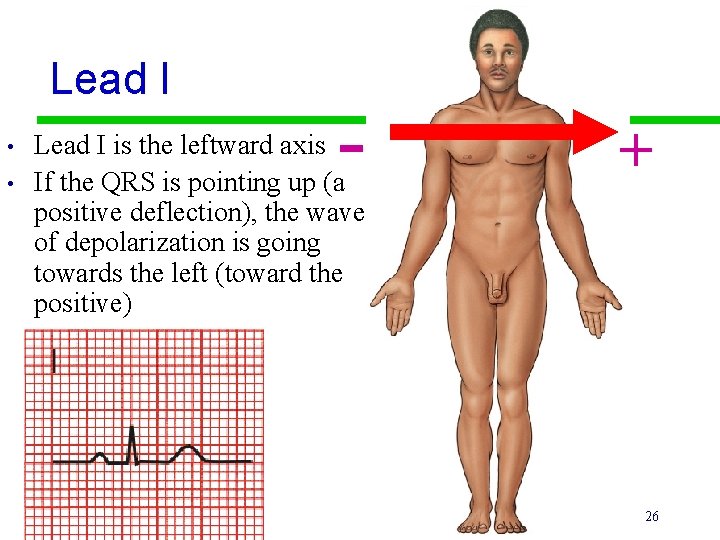 Lead I • • - Lead I is the leftward axis If the QRS