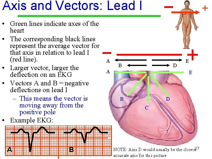 Axis and Vectors: Lead I • Green lines indicate axes of the heart •