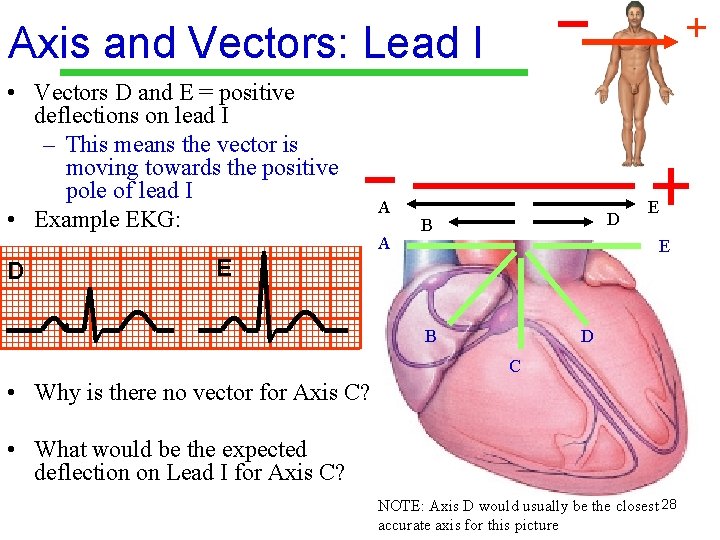 + Axis and Vectors: Lead I • Vectors D and E = positive deflections