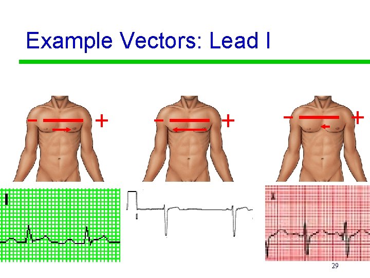 Example Vectors: Lead I 29 