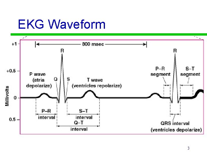 EKG Waveform 3 