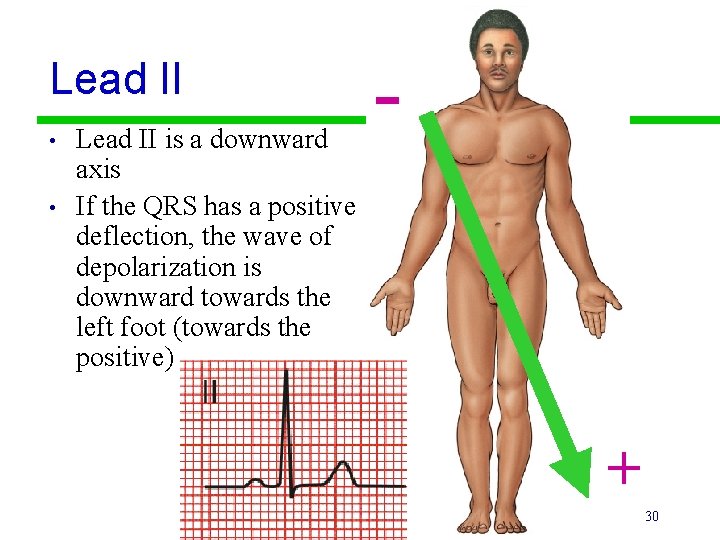 Lead II • • Lead II is a downward axis If the QRS has