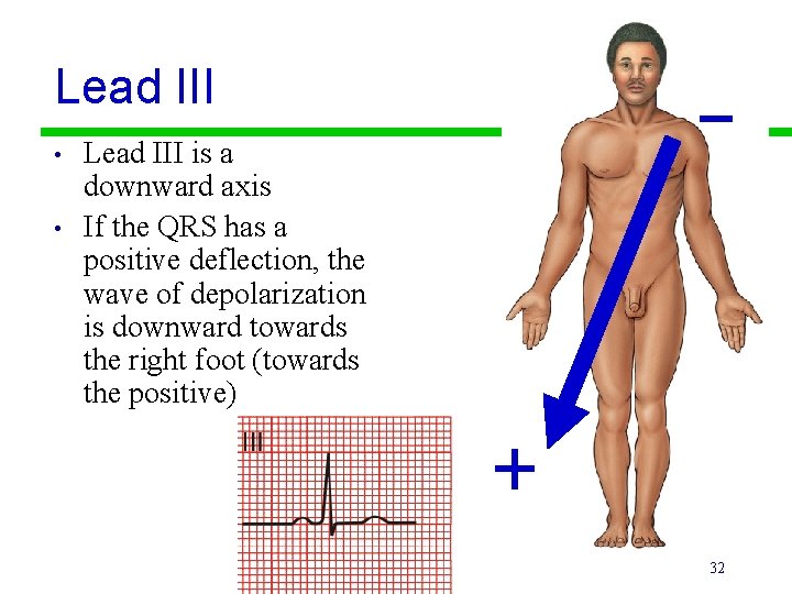 Lead III • • Lead III is a downward axis If the QRS has