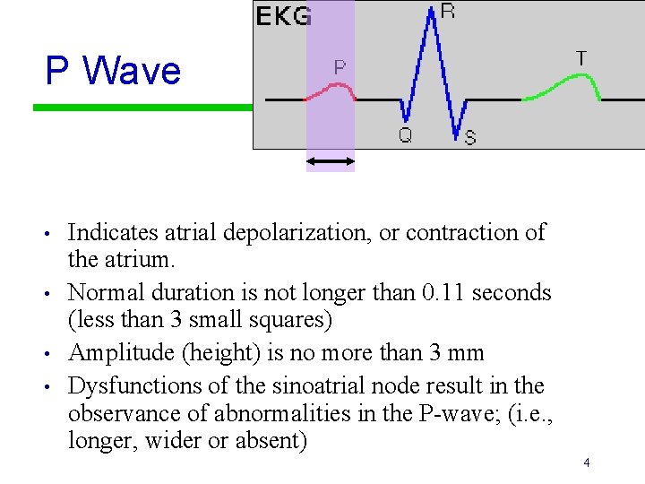 P Wave • • Indicates atrial depolarization, or contraction of the atrium. Normal duration