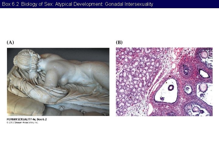 Box 6. 2 Biology of Sex: Atypical Development: Gonadal Intersexuality 