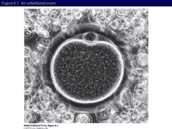 Figure 6. 1 An unfertilized ovum 