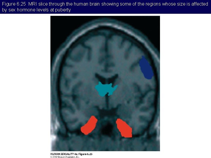 Figure 6. 25 MRI slice through the human brain showing some of the regions