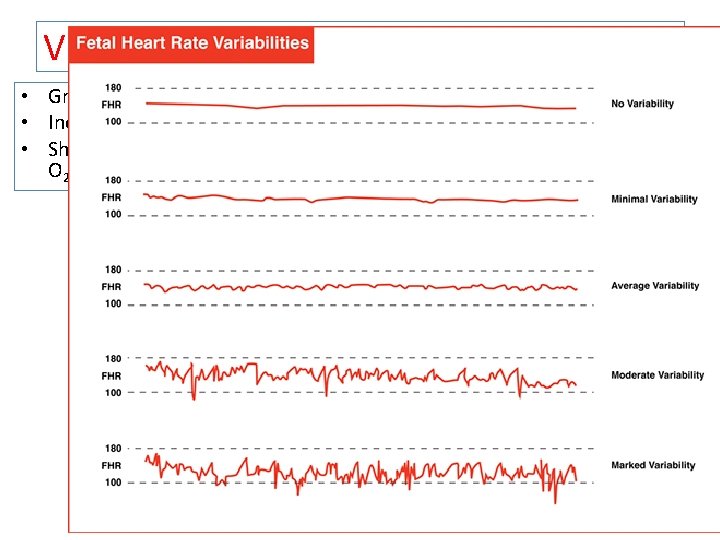 Variability • Greater than 5 bpm and less than 25 bpm • Increased variability