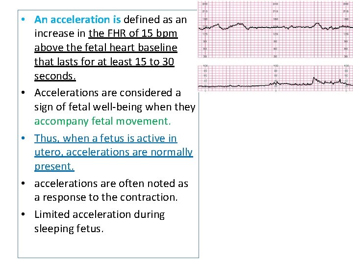  • An acceleration is defined as an increase in the FHR of 15