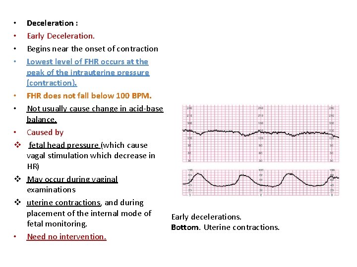 Deceleration : Early Deceleration. Begins near the onset of contraction Lowest level of FHR