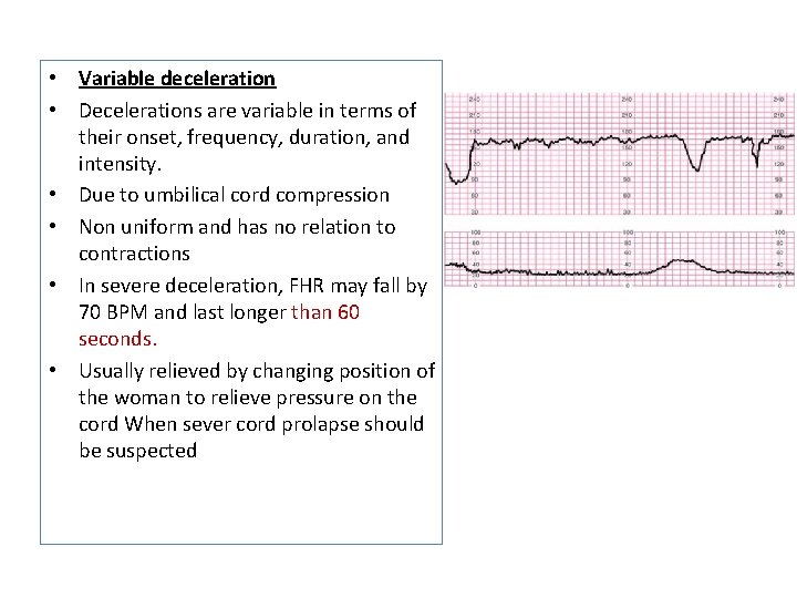  • Variable deceleration • Decelerations are variable in terms of their onset, frequency,