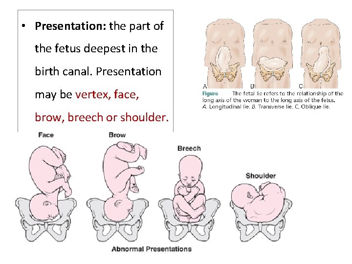  • Presentation: the part of the fetus deepest in the birth canal. Presentation