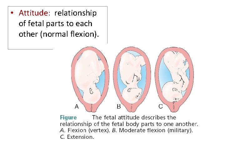  • Attitude: relationship of fetal parts to each other (normal flexion). 