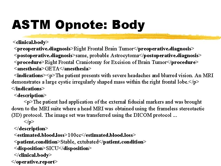 ASTM Opnote: Body <clinical. body> <preoperative. diagnosis>Right Frontal Brain Tumor</preoperative. diagnosis> <postoperative. diagnosis>same, probable
