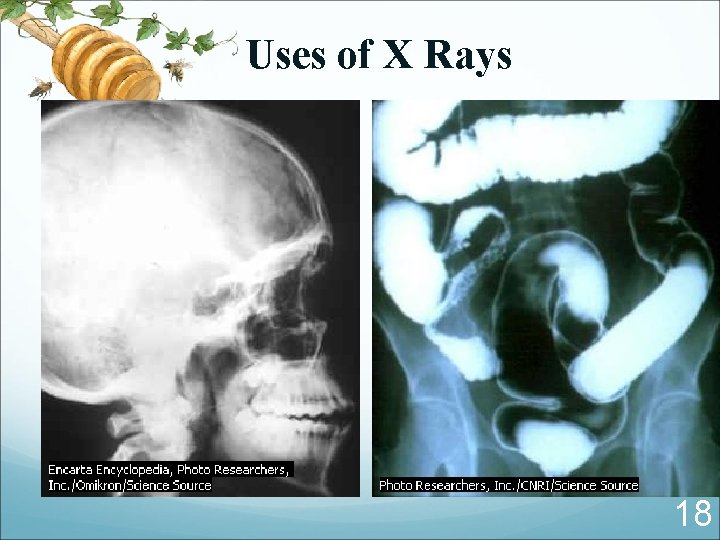 Uses of X Rays 18 