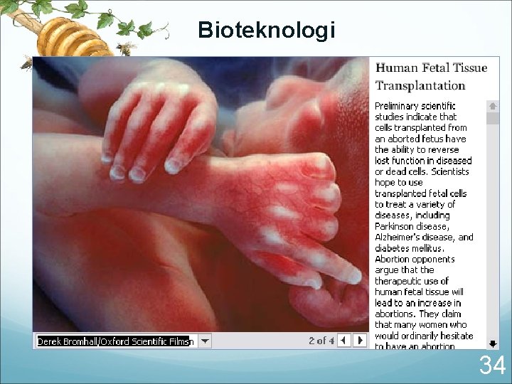 Bioteknologi 34 