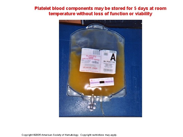 Platelet blood components may be stored for 5 days at room temperature without loss