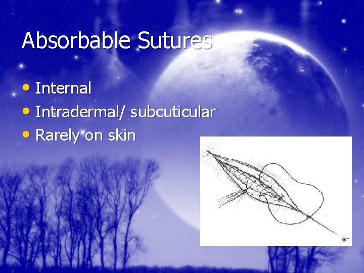 Absorbable Sutures • Internal • Intradermal/ subcuticular • Rarely on skin 