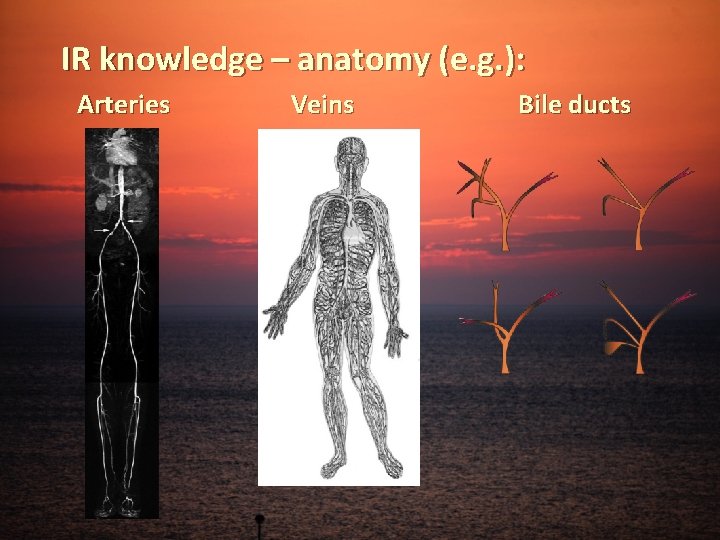 IR knowledge – anatomy (e. g. ): Arteries Veins Bile ducts 
