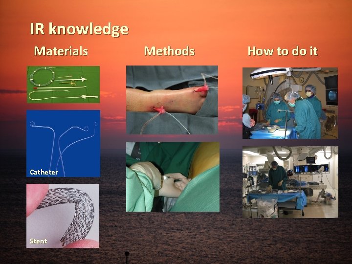 IR knowledge Materials Catheter Stent Methods How to do it 