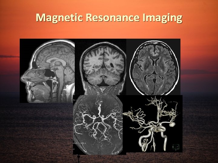 Magnetic Resonance Imaging 