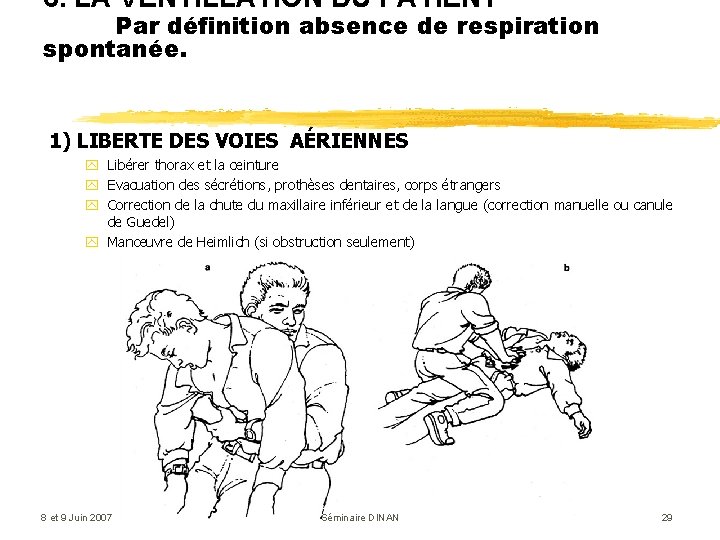 6. LA VENTILLATION DU PATIENT Par définition absence de respiration spontanée. 1) LIBERTE DES