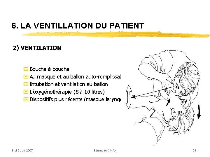 6. LA VENTILLATION DU PATIENT 2) VENTILATION y Bouche à bouche y Au masque