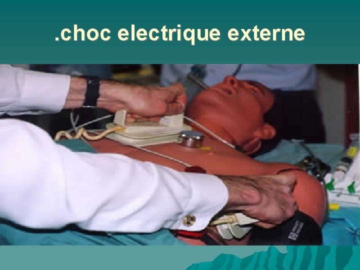 . choc electrique externe 