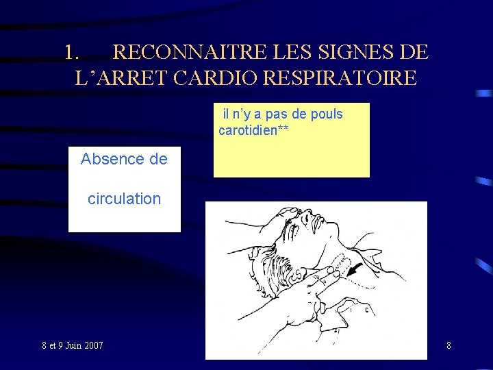 1. RECONNAITRE LES SIGNES DE L’ARRET CARDIO RESPIRATOIRE -il n’y a pas de pouls