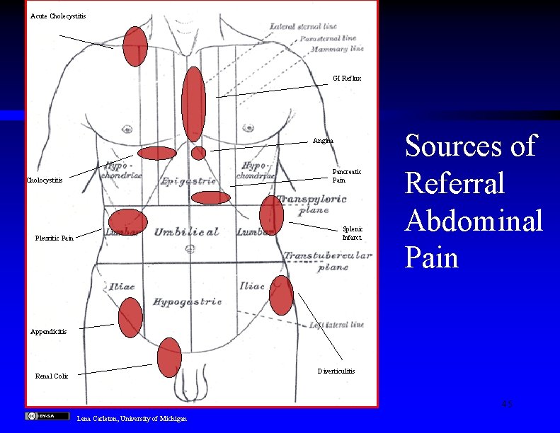 Acute Cholecystitis GI Reflux Angina Pancreatic Pain Cholocystitis Splenic Infarct Pleuritic Pain Sources of
