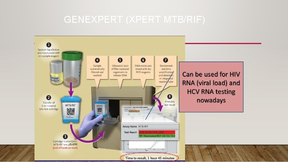 GENEXPERT (XPERT MTB/RIF) 