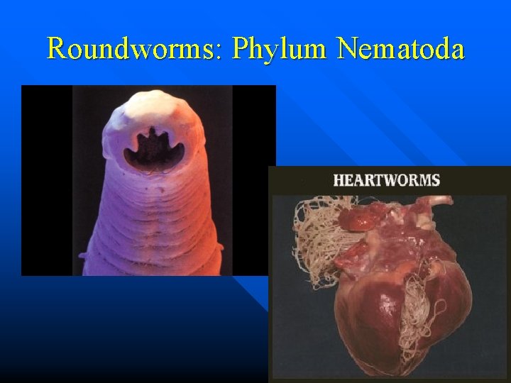 Roundworms: Phylum Nematoda 