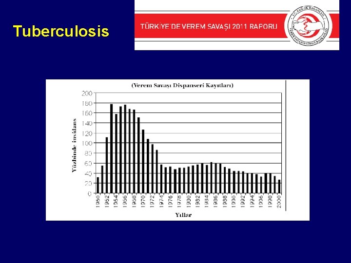 Tuberculosis 