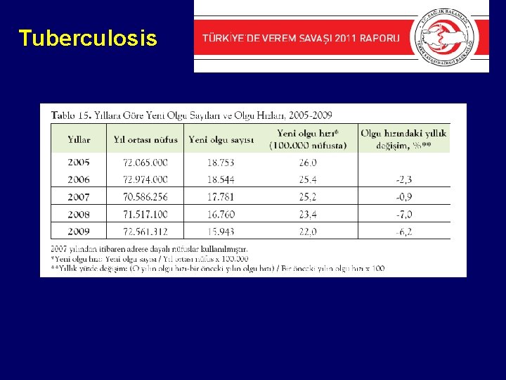 Tuberculosis 