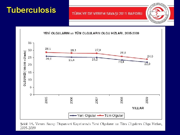 Tuberculosis 