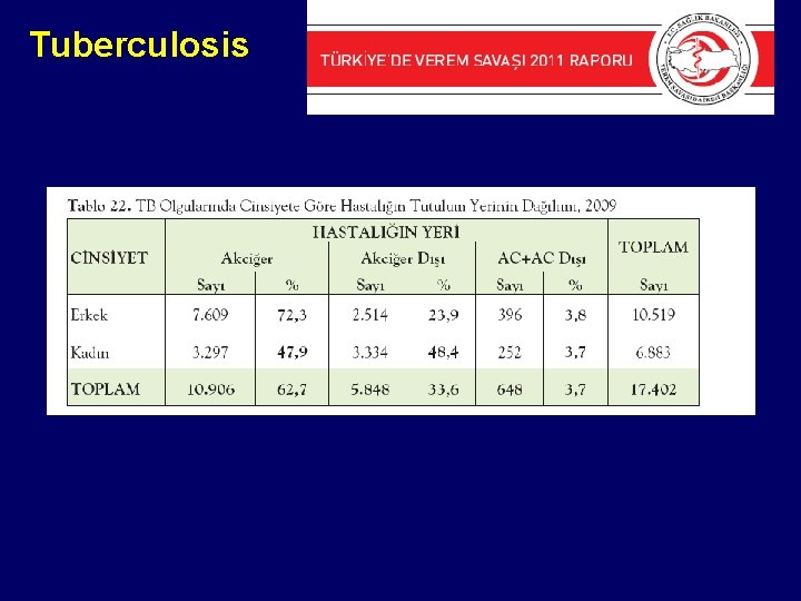 Tuberculosis 