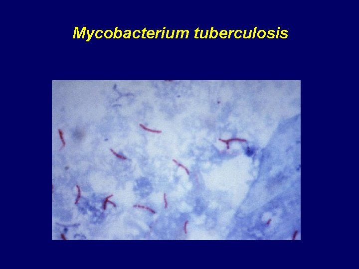 Mycobacterium tuberculosis 