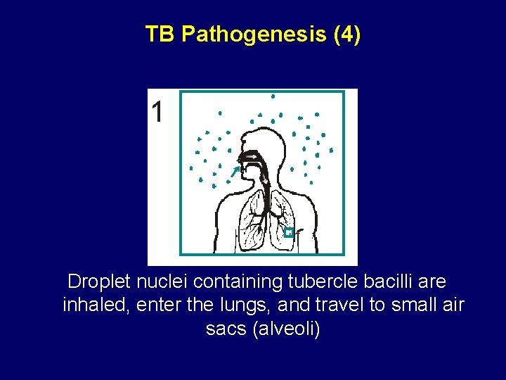 TB Pathogenesis (4) Droplet nuclei containing tubercle bacilli are inhaled, enter the lungs, and