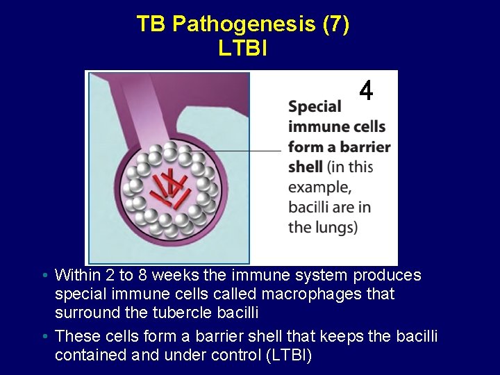 TB Pathogenesis (7) LTBI 4 • Within 2 to 8 weeks the immune system