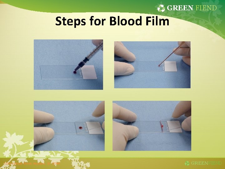 GREEN FIEND Steps for Blood Film 1234 Sample Street, Anytown, St. 12345 GREENFIEND 