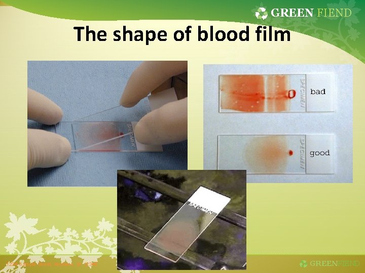 GREEN FIEND The shape of blood film 1234 Sample Street, Anytown, St. 12345 GREENFIEND