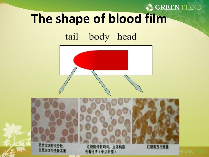 GREEN FIEND The shape of blood film 1234 Sample Street, Anytown, St. 12345 GREENFIEND
