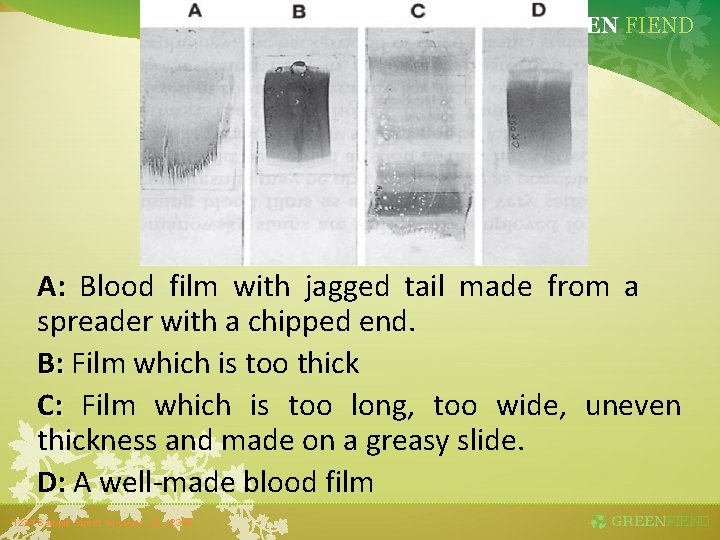 GREEN FIEND A: Blood film with jagged tail made from a spreader with a