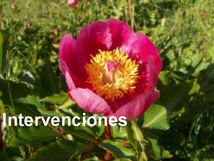 Intervenciones 