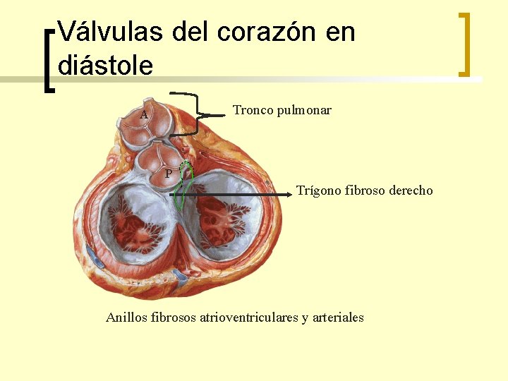 Válvulas del corazón en diástole Tronco pulmonar A P Trígono fibroso derecho Anillos fibrosos