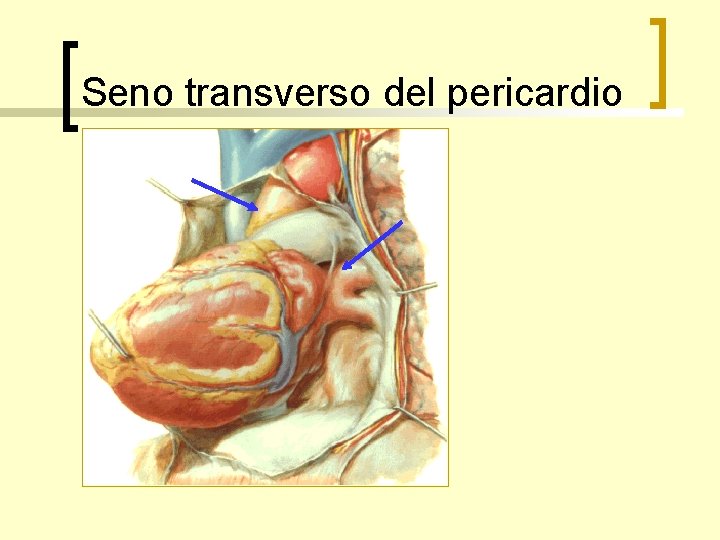 Seno transverso del pericardio 