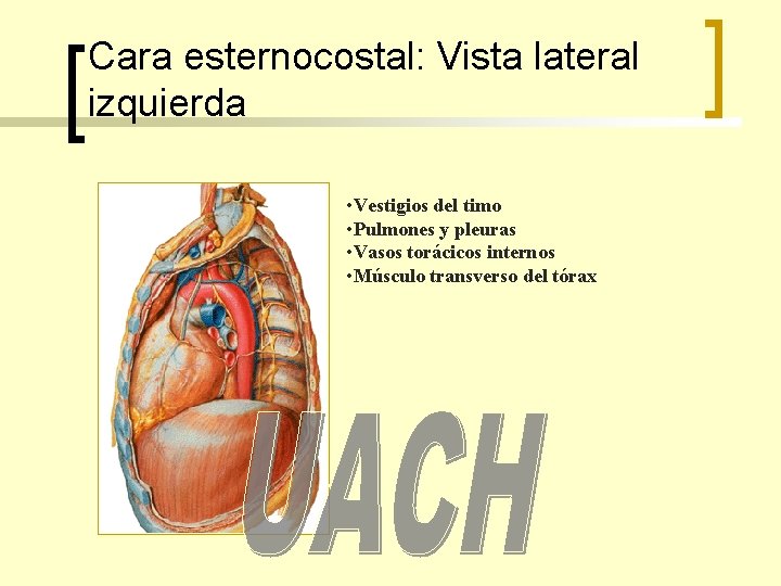 Cara esternocostal: Vista lateral izquierda • Vestigios del timo • Pulmones y pleuras •