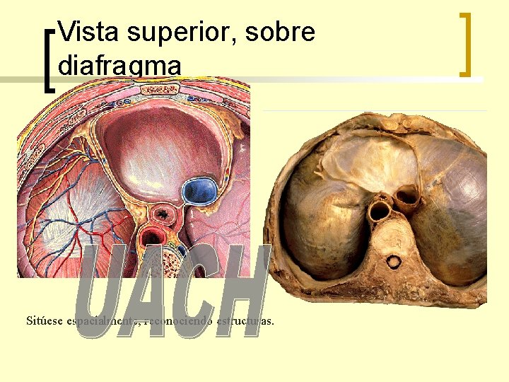 Vista superior, sobre diafragma Sitúese espacialmente, reconociendo estructuras. 