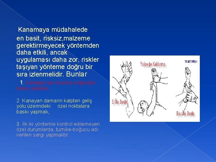 Kanamaya müdahalede en basit, risksiz, malzeme gerektirmeyecek yöntemden daha etkili, ancak uygulaması daha zor,